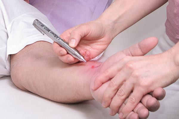 Lasertherapie - Inge Hannesschläger, Physiotherapeutin Klagenfurt